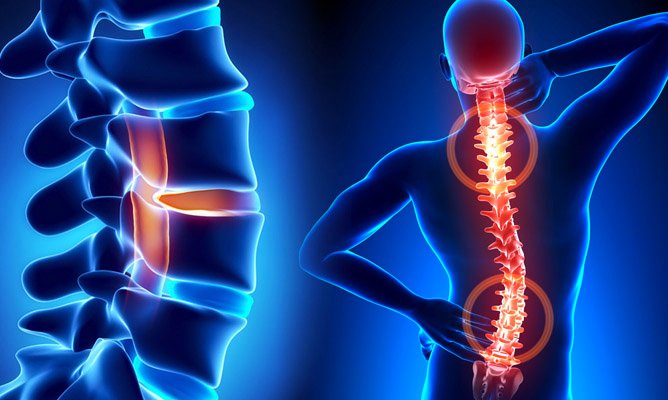 Spine